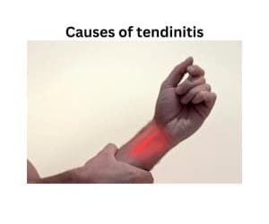 The Guide to Managing tendinitis, inflammation and pain in your wrist and forearm.